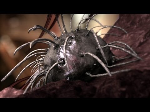 Chromobacterium Infection - Monsters Inside Me Ep5