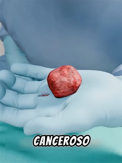 IL CHIRURGO CHE SI INFETTO TRAMITE UN TAGLIO (credits:@Zack D. Films) #fypシ #viralstories #pertee