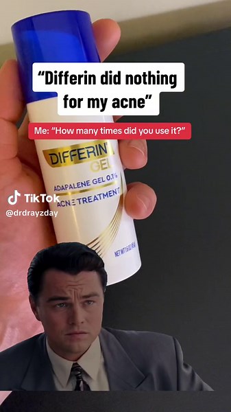 In order to get results from Adapalene (aka Differin gel) you have to use it regularly for several weeks before seeing any results. Adapalene starts working immediately and you may see results in as little as two weeks. However, it may take time to see significant results, but with continued use, it is proven to work. Patients generally can expect to see an 87% decrease in their acne after 12 weeks of use. However, for some patients it may take longer. Also, it is important to realize that adapa