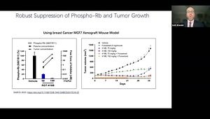 SABCS 2023 Insights: "A Study of RGT-419B, a Next-Gen CDK4 Inhibitor, in Pts With HR /HER2- Advanced or Metastatic BC Who Progressed on Prior CDK4/6i"