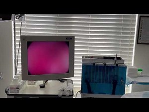 Rezum Procedure Performed At A Rezum Center Of Excellence