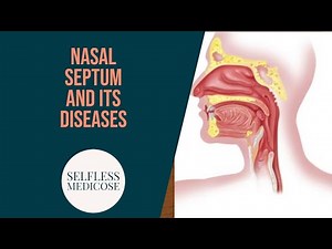 NASAL SEPTUM and DISEASES part 5, septal abscess