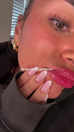 Exploring Birthmarks and Past Life Kisses