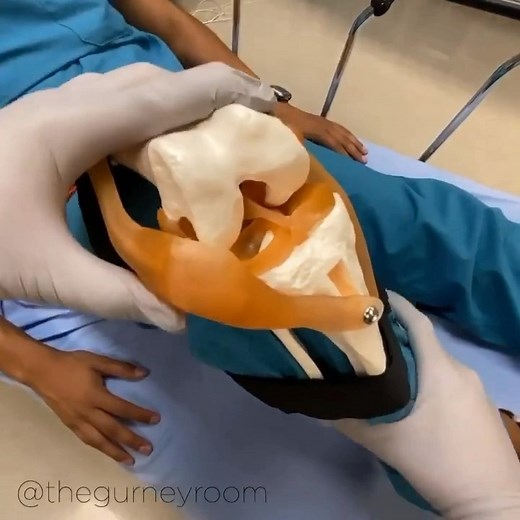 Dr. Tom Walters, DPT, OCS on Instagram: "💥𝐏𝐚𝐭𝐞𝐥𝐥𝐚𝐫 𝐝𝐢𝐬𝐥𝐨𝐜𝐚𝐭𝐢𝐨𝐧 𝐑𝐞𝐝𝐮𝐜𝐭𝐢𝐨𝐧💥 —— 👉The other day I shower a patellar dislocation in a soccer player and shared a post with a few rehab exercises. Here is a great post from the @thegurneyroom that shows the anatomy of a patellar dislocation reduction. - 📚Patella dislocation often occurs from strong quadriceps contraction with external rotation of the ankle. This can happen with a sudden lateral “cut” while playing sports l