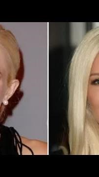 Heidi Montag: 'Plastic' Surgery Before and After Photos: Why She Almost Died