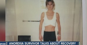 CO anorexia survivor shares story of recovery