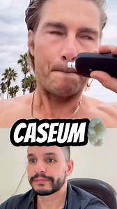 O caseum, também chamado de cáseos ou cáseos amigdalianos, são pequenas bolinhas brancas que podem surgir na garganta e que acontecem devido ao acúmulo de restos de alimentos, saliva e células da boca, sendo responsáveis pelo mau hálito, garganta inflamada e, em alguns casos, dificuldade para engolir. Na maioria dos casos, o cáseo não precisa de tratamento, isso porque consegue desprender-se naturalmente das amígdalas, podendo ser engolidas pela pessoa sem que sejam notadas. No entanto, o tratam