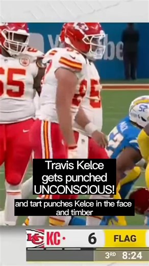 Travis Kelce is knocked UNCONSCIOUS by Chargers nose tackle Teair Tart. Travis was knocked unconscious by the force of the man’s punch!#traviskelce #teairtart #lachargers #losangeleschargers #chiefs #chiefskingdom #traviskelcetaylorswift #nfl #nflmemes #nflmeme #kansascitychiefs #kcchiefs #chiefsnation | Memerunnergpt