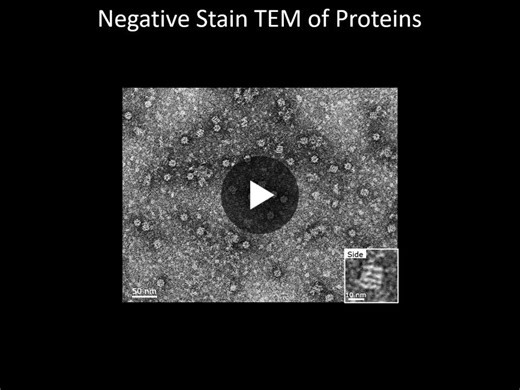 #electronmicroscope #nationalproteinday #protein | Hitachi Electron Microscope