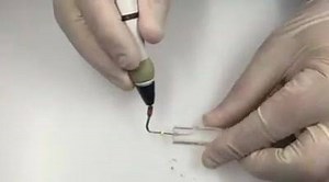 116 reactions · 53 shares | A video on: how I use the warm vertical condensation technique to fill canals! Down pack (System B) and Backfill (Obturation). Currently I'm using the Calamus dual unit in practice | Specialist Endo Sydney- Clinical hacks | Facebook