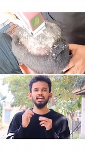 Dandruff gone, confidence on ✨ one wash closer to a clean, itch-free scalp. Keywords: anti dandruff shampoo, dandruff control, itchy scalp relief, flake free hair, healthy scalp, hair care routine, scalp care, clean scalp, hair wash, no dandruff Hashtags (5): #AntiDandruff #DandruffFree #HealthyScalp #HairCareRoutine #FlakeFree | Pavan Influencer