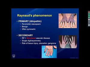 Rheumatology Pearls in Systemic Sclerosis   • Video • MEDtube.net