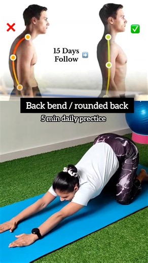 Fix Tech Neck & Improve Your Posture with This Simple Stretch !! #posture #neckhump #yoga #shorts