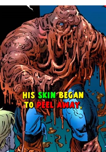 The Thing WORST Dream Ever!#marvel #comics