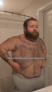The transformation continues, 2026 is going to be wild. . . . . #skinremoval #weightlosstransformation #sober | Garrettwelsh