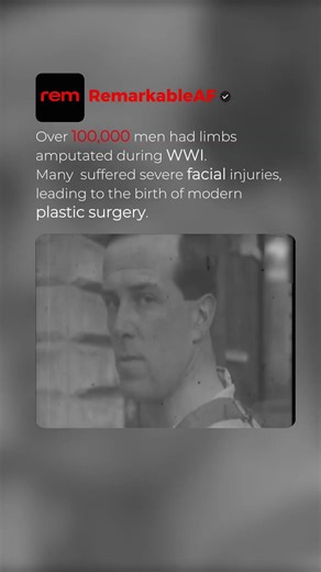 What u missed about World War one | 100,000 Soldiers Needed Face Reconstruction #ww1 #history #usa