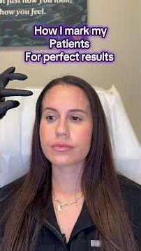 How to analyze facial muscles and mark for Botox