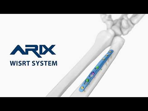 [ARIX OS] ARIX Ulna Osteotomy System