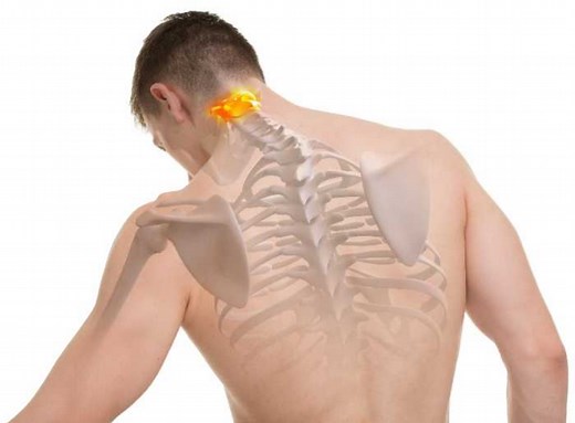 Entenda o que é fratura do processo odontoide - ITC Vertebral