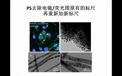 【科研绘图】PS去除电镜图/共聚焦荧光图原有的标尺再重新加新标尺