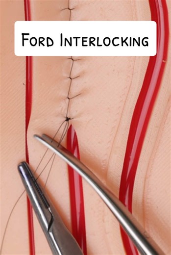Ford Interlocking Sutures Explained for Veterinary Students