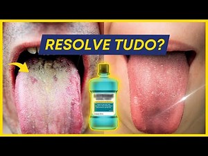 ENXAGUANTE BUCAL ACABA COM A LÍNGUA BRANCA? VERDADE REVELADA.