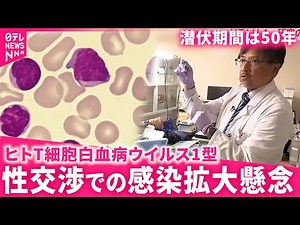 【注意】白血病引き起こす恐れ "HTLV-1" 感染拡大防ぐには？ 宮崎 NNNセレクション