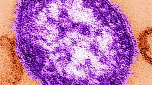 Adult contagious with measles was at Ridgefield High, Clark County health says