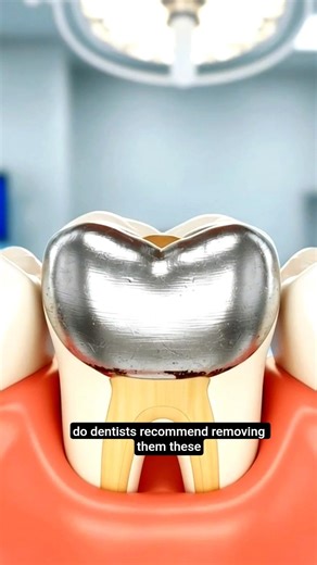 Why Your Old Dental Fillings Need Replacement#DentalHealth#SilverFillings#ToothFilling#oralhealth