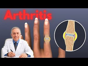 Arthritis Symptoms & Causes You Can’t Ignore