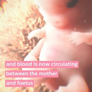 336 reactions · 22 shares | Prepare for your baby’s arrival with our Pregnancy+ app  | Pregnancy+ App | Facebook