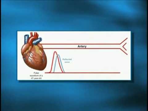ericglenn.com - Cardio Pulse Wave Analyzer Introduction