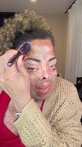 I contoured my tissue expander the other day! Do what makes you happy!🦋Love y’all!😘 #beauty • #beautyblog • #beautybloggers • #beautycare • #beautymakeup • #beautytips • #burnsurvivor • #loveyourself • #makeup • #makeupaddict • #makeupartist • #makeupideas • #makeuplover • #makeupoftheday • #makeuptutorial • #mua • #positivevibes • #selfcare • #selflove • #success • #thistooshallpass • #blackgirlmagic • | BurnedBeauty2018