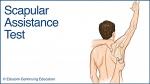 Scapular Assistance Test - Chiropractic Online CE