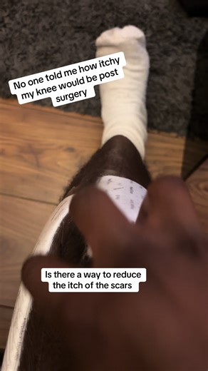 My scars are sooooo itchy, is it just me??? #acl #itchy #healingjourney #scar #aclrecovery