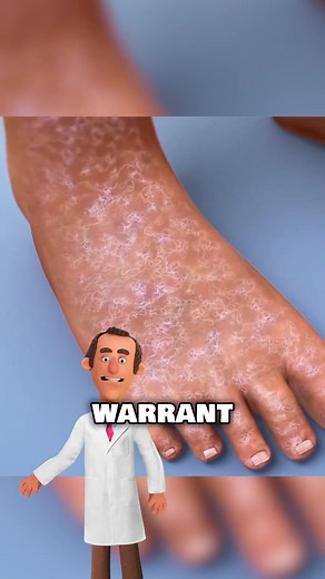 7 Foot Symptoms Indicating Vitamin Deficiencies