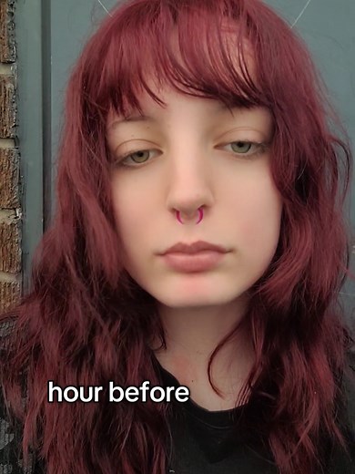 Vertical Labret Piercing Healing Journey