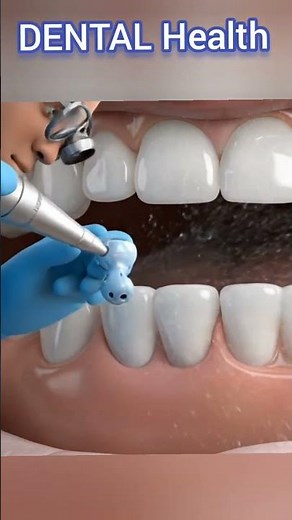 “Replacing a Missing Tooth with a Fixed Dental Bridge” #dentist #dentalarch