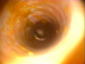 Veterinary.Colonoscopy from a dog, normal, fully www.en.endovet.su