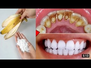 HOW TO REMOVE DENTAL PLAQUE AT HOME IN 2 MINUTES WITHOUT WASTING YOUR MONEY AT THE DENTIST