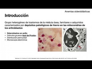 Anemias sideroblasticas