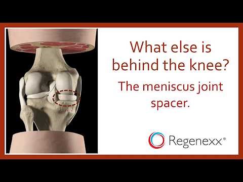 Back of Knee Pain : What's Wrong?