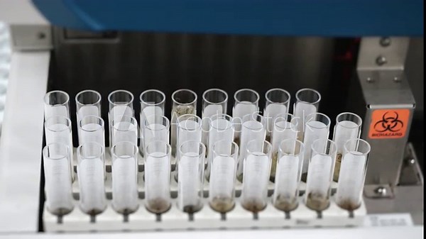 Automated urine analyzer processes multiple test tubes with samples in a modern medical laboratory environment, showing motion and diagnostic precision.