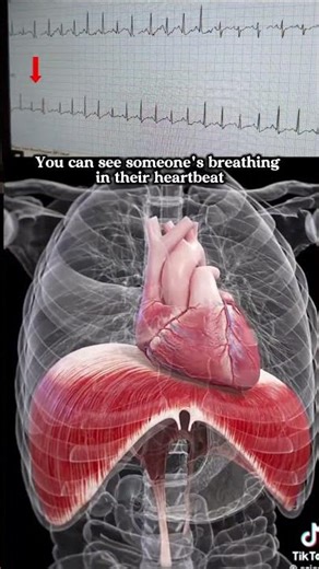 Cardiopulmonary coupling in action. 🫀🫁 #electrophysiology #cardiology #heart #lungs