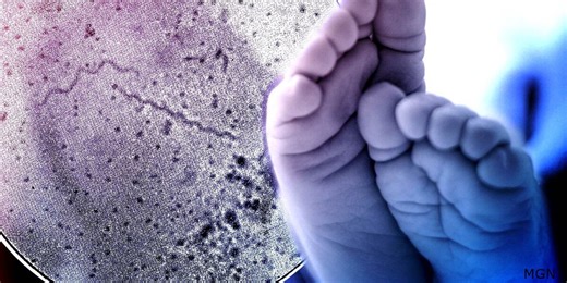 New syphilis screening recommendations