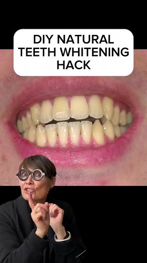 DIY Natural Teeth Whitening Routine for White, Bright Smiles
