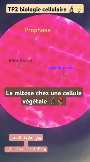 Les phases de # mitose en microscope🔬cellule végétale🌱#Biologie cellulaire💙#TP2 #Bac # وئام الأماني💡