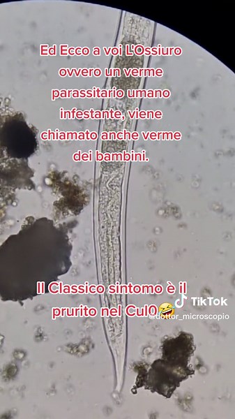 Ossiuri: Il Verme Parassitario umano | Sintomi, Trattamento e Microscopio