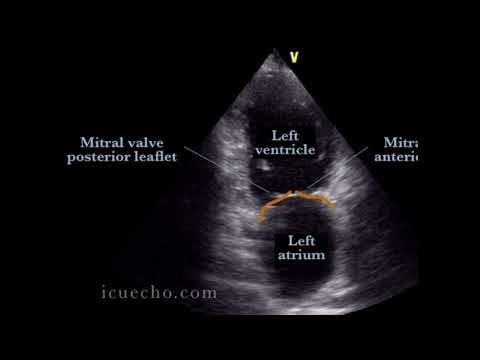 Transthoracic echocardiographic views