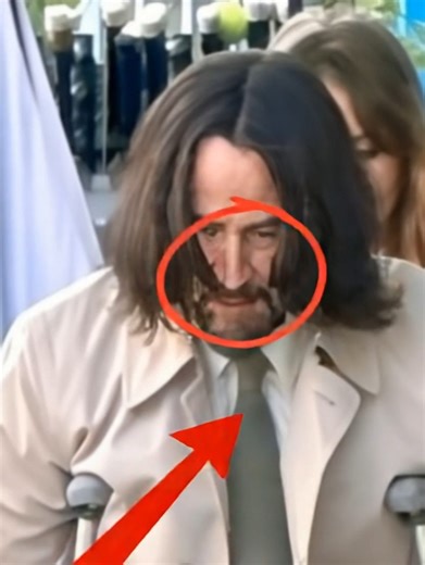 3K views | Our Favorite Actor Is In Trouble Action Star Spotted Struggling on Crutches! Mystery Injury Has Fans Talking! Who Is He And What's Happened WIth Him Know In the First Comment⬇️⬇️⬇️ | I Love Julia Roberts | Facebook